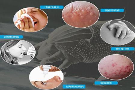家用新风机减轻过敏反应 家用新风机减轻过敏反应